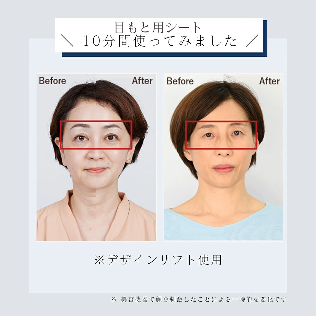 楽天市場】【ふるさと納税】デザインリフト モア 目元/口元ケアセット