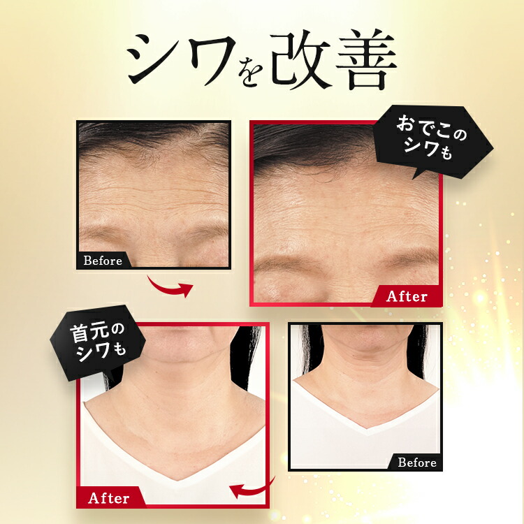 楽天市場】【公式】パーフェクトワン 薬用リンクルストレッチジェル