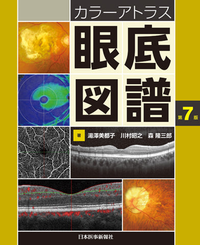 カラーアトラス眼底図譜 – 日本医事新報社