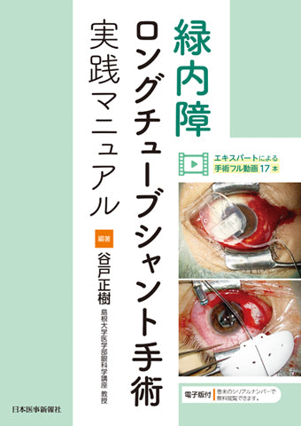 緑内障ロングチューブシャント手術実践マニュアル – 日本医事新報社