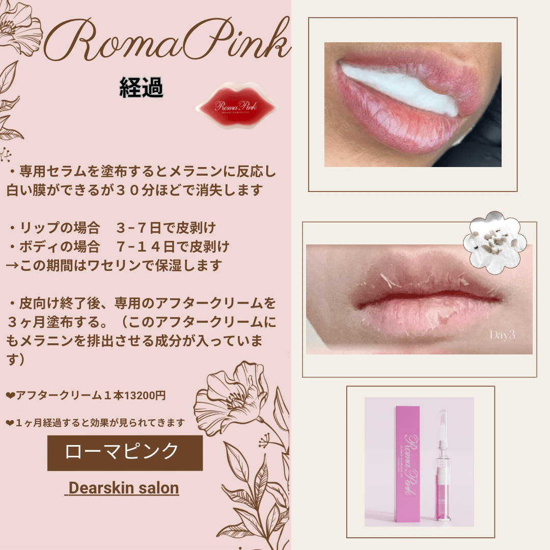 話題のローマピンク、施術方法は？ダウンタイムは？ （Dearskin